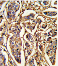 AP18219PU-N - Thrombospondin-1 (THBS1)