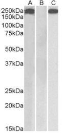 AP33184PU-N - Thrombospondin-1 (THBS1)