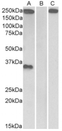 AP33185PU-N - Thrombospondin-1 (THBS1)