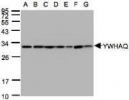 NBP1-31537 - 14-3-3 protein theta