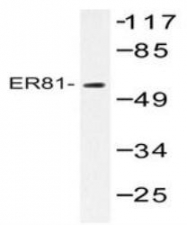 NBP1-19679 - ETV1 / ER81
