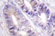 NB100-92268 - 14-3-3 protein zeta/delta