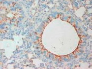 PAB12275 - MMP-8