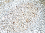 55451-1-AP - CLEC9A