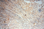 17874-1-AP - MMP-8