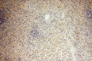 17874-1-AP - MMP-8