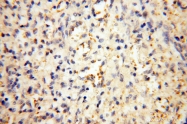 17874-1-AP - MMP-8