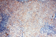 17874-1-AP - MMP-8