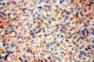 17874-1-AP - MMP-8