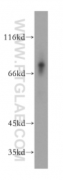 17874-1-AP - MMP-8