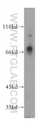 17874-1-AP - MMP-8