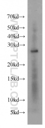 15222-1-AP - 14-3-3 protein eta