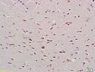 bs-0127M - Bax