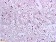 bs-0127R - Bax