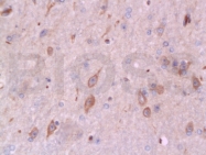 bs-0127R - Bax