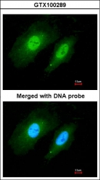 GTX100289 - 14-3-3 protein sigma / SFN