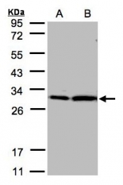 GTX101075 - 14-3-3 protein zeta/delta