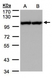 GTX101089 - TER ATPase / VCP