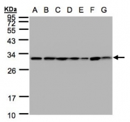 GTX102199 - 14-3-3 protein theta