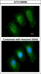 GTX109090 - 14-3-3 protein epsilon