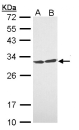 GTX112026 - 14-3-3 protein theta