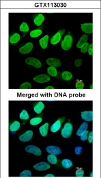 GTX113030 - TER ATPase / VCP
