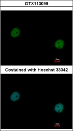 GTX113099 - TER ATPase / VCP