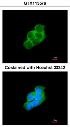 GTX113576 - 14-3-3 protein epsilon