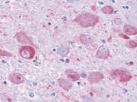 Fig. 2: <span>SP4420P NPY1R antibody immunohistochemical staining of Brain.</span>