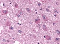Fig. 6: <span>Immunohistochemical staining of Brain using anti- PPYR1 antibody SP4421P.</span>