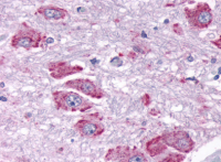 Fig. 5: <span>Immunohistochemical staining of Brain using anti- PPYR1 antibody SP4422P</span>