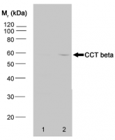 Fig. 3:<span>Western blot analysis of HeLa whole cell lysate (Lane 1) and HeLa heat stressed whole cell lysate (Lane 2) probed with Rat Anti Human CCT Beta antibody (SM2016P) followed by F(ab')2 Rabbit Anti Rat IgG:HRP (SP1021HRP).</span> Fig. 3:<span>Western blot analysis of HeLa whole cell lysate (Lane 1) and HeLa heat stressed whole cell lysate (Lane 2) probed with Rat Anti Human CCT Beta antibody (SM2016P) followed by F(ab')2 Rabbit Anti Rat IgG:HRP (SP1021HRP).</span>