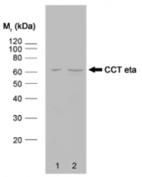 Fig. 11: <span>Western blot analysis of HeLa whole cell lysate (lane 1) and HeLa heat stressed whole cell lysate (lane 2) probed with rat anti CCT Eta Cat.-No. SM2019P followed by F(ab')2 rabbit anti rat IgG:HRP (Cat.No. SP1021HRP).</span> Fig. 11: <span>Western blot analysis of HeLa whole cell lysate (lane 1) and HeLa heat stressed whole cell lysate (lane 2) probed with rat anti CCT Eta Cat.-No. SM2019P followed by F(ab')2 rabbit anti rat IgG:HRP (Cat.No. SP1021HRP).</span>