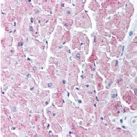 Fig. 2: BP508 GLUT4 antibody staining of Paraffin Embedded Human Heart, demonstrating labelling of cardiac myocytes. Fig. 2: BP508 GLUT4 antibody staining of Paraffin Embedded Human Heart, demonstrating labelling of cardiac myocytes.