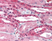 Fig. 1: AP07454PU-N GLUT10 antibody staining of Formalin-Fixed Paraffin-Embedded Human Kidney. Fig. 1: AP07454PU-N GLUT10 antibody staining of Formalin-Fixed Paraffin-Embedded Human Kidney.