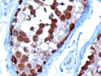 Fig. 1: TCP1 antibody Cat.-No. AP16211PU-N staining of paraffin embedded human testis at 10 µg/ml. Microwaved antigen retrieval with Tris/EDTA buffer pH9, HRP-staining. Fig. 1: TCP1 antibody Cat.-No. AP16211PU-N staining of paraffin embedded human testis at 10 µg/ml. Microwaved antigen retrieval with Tris/EDTA buffer pH9, HRP-staining.