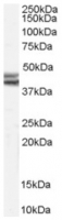 Fig. 4: <span>AP16644PU-N NPY2R antibody staining of Rat Brain lysate at 0.1 µg/ml (35 µg protein in RIPA buffer). Primary incubation was 1 hour. Detected by chemiluminescence.</span>