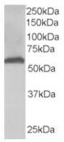 Fig. 2: <span>FTCD Antibody staining (AP16258PU-N at 0.03µg/ml) of Human Liver lysate (35µg protein in RIPA buffer). Primary incubation was 1 hour. Detected by chemiluminescence.</span>