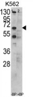 Fig. 5: <span>Western blot analysis of CCT3 Antibody (C-term) (AP17199PU-N) in K562 cell line lysates (35 µg/lane). CCT3 (arrow) was detected using the purified Pab.</span> Fig. 5: <span>Western blot analysis of CCT3 Antibody (C-term) (AP17199PU-N) in K562 cell line lysates (35 µg/lane). CCT3 (arrow) was detected using the purified Pab.</span>