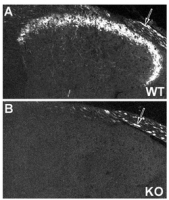 Fig. 3: <span>NPY Y2 receptor immunoreactivity in Mouse dorsal root ganglion of wild type (A) and NPY Y2 receptor Knockout (B) animals. Note that unspecific staining is observed in thick, possibly myelinated fibers. Image courtesy of Dr. Tomas Hökfelt, Karolinska Institute.</span>