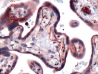 Fig. 3: Human placenta stained with anti-GLUT-3 antibody. Fig. 3: Human placenta stained with anti-GLUT-3 antibody.