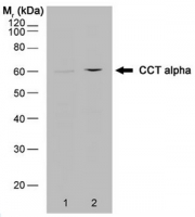 Fig. 2: Western blot analysis of HeLa whole cell lysate (lane 1) and HeLa heat stressed whole cell lysate (lane 2) probed with rat anti mouse CCT alpha Cat.-No. SM2173P followed by F(ab')2 rabbit anti Rat IgG:HRP (Cat.-No. SP1021HRP) Fig. 2: Western blot analysis of HeLa whole cell lysate (lane 1) and HeLa heat stressed whole cell lysate (lane 2) probed with rat anti mouse CCT alpha Cat.-No. SM2173P followed by F(ab')2 rabbit anti Rat IgG:HRP (Cat.-No. SP1021HRP)