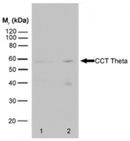 Fig. 13: <span>Western blot analysis of HeLa whole cell lysate (lane 1) and HeLa heat stressed whole cell lysate (lane 2) probed with rat anti CCT theta Cat.-No. SM2017P followed by F(ab')2 rabbit anti rat IgG:HRP (Cat.-No. SP1021HRP).</span> Fig. 13: <span>Western blot analysis of HeLa whole cell lysate (lane 1) and HeLa heat stressed whole cell lysate (lane 2) probed with rat anti CCT theta Cat.-No. SM2017P followed by F(ab')2 rabbit anti rat IgG:HRP (Cat.-No. SP1021HRP).</span>