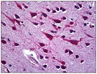 Fig. 7: <span>Human Brain, Cortex: Formalin-Fixed, Paraffin-Embedded (FFPE)</span> Fig. 7: <span>Human Brain, Cortex: Formalin-Fixed, Paraffin-Embedded (FFPE)</span>