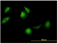 Fig. 8: <span>Immunofluorescence of monoclonal antibody to CCT5 on HeLa cell. [antibody concentration 10 µg/ml]</span>