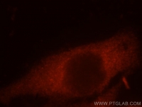 Fig. 14: <span>Immunofluorescent analysis of MCF-7 cells, using CCT8 antibody 12263-1-AP at 1:25 dilution and Rhodamine-labeled goat anti-rabbit IgG (red).</span> Fig. 14: <span>Immunofluorescent analysis of MCF-7 cells, using CCT8 antibody 12263-1-AP at 1:25 dilution and Rhodamine-labeled goat anti-rabbit IgG (red).</span>