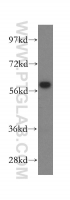 Fig. 12: <span>Hela cell were subjected to SDS PAGE followed by western blot with 15994-1-AP(CCT7 Antibody) at dilution of 1:1500</span> Fig. 12: <span>Hela cell were subjected to SDS PAGE followed by western blot with 15994-1-AP(CCT7 Antibody) at dilution of 1:1500</span>