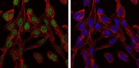 Fig. 4: <span>Immunofluorescence analysis of 3T3-L1 cells using CCT2 mouse mAb (green). Blue: DRAQ5 fluorescent DNA dye. Red: Actin filaments have been labeled with Alexa Fluor-555 phalloidin.</span> Fig. 4: <span>Immunofluorescence analysis of 3T3-L1 cells using CCT2 mouse mAb (green). Blue: DRAQ5 fluorescent DNA dye. Red: Actin filaments have been labeled with Alexa Fluor-555 phalloidin.</span>