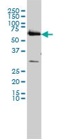 <span>CCT6B monoclonal antibody (M01), clone 1A4 Western Blot analysis of CCT6B expression in HL-60 ( Cat # L014V1 ).</span> <span>CCT6B monoclonal antibody (M01), clone 1A4 Western Blot analysis of CCT6B expression in HL-60 ( Cat # L014V1 ).</span>
