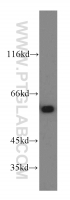 Fig. 9: <span>Hela cell were subjected to SDS PAGE followed by western blot with 19793-1-AP(CCT6A-Specific Antibody) at dilution of 1:600</span> Fig. 9: <span>Hela cell were subjected to SDS PAGE followed by western blot with 19793-1-AP(CCT6A-Specific Antibody) at dilution of 1:600</span>